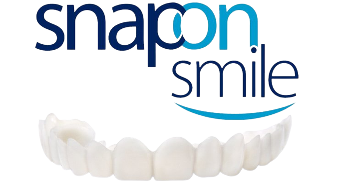 snap-on-smile-prod-1-2.png